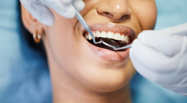 Best Emergency Root Canal Treatment in Eureka, KS